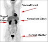 petscan_normal[2]